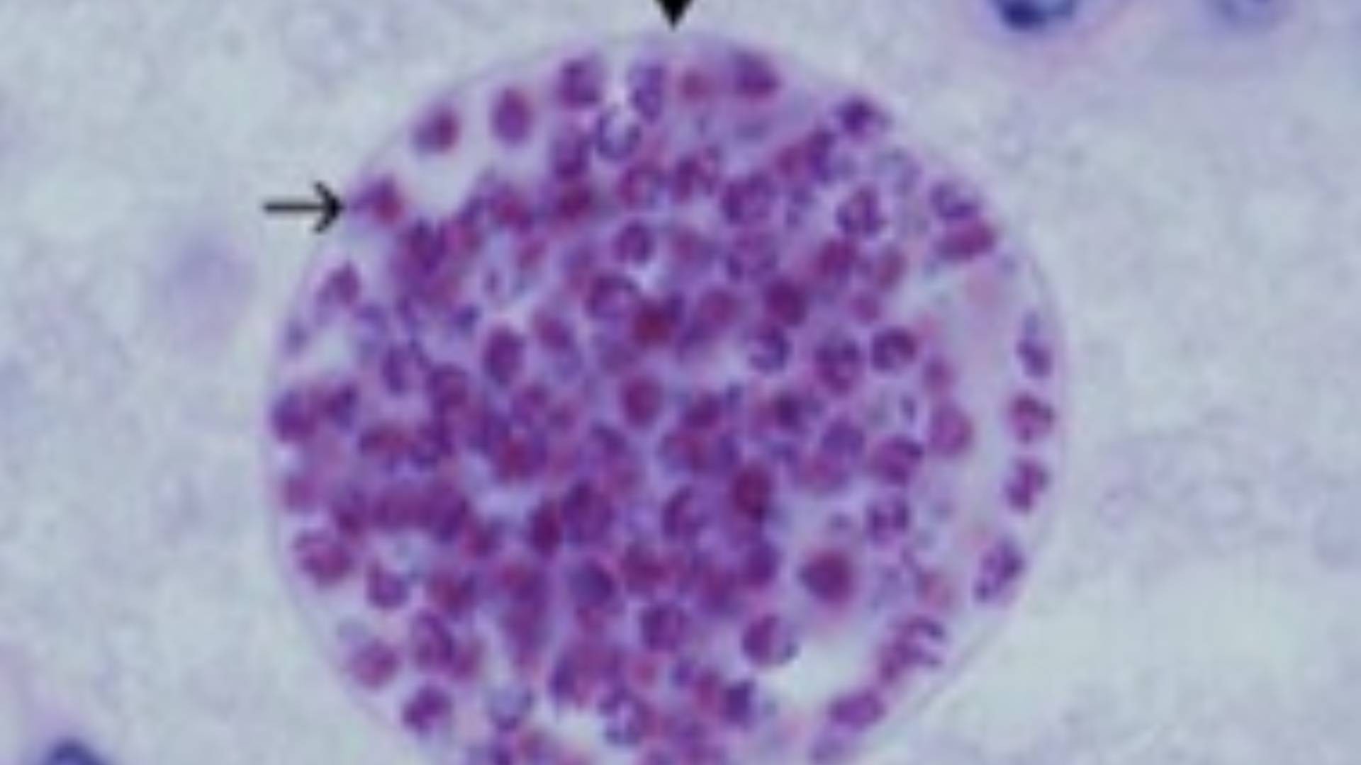 Respons Sistem Imun Terhadap Infeksi Toksoplasmosis  Toxoplasma Gondii  Pada Hewan Ternak